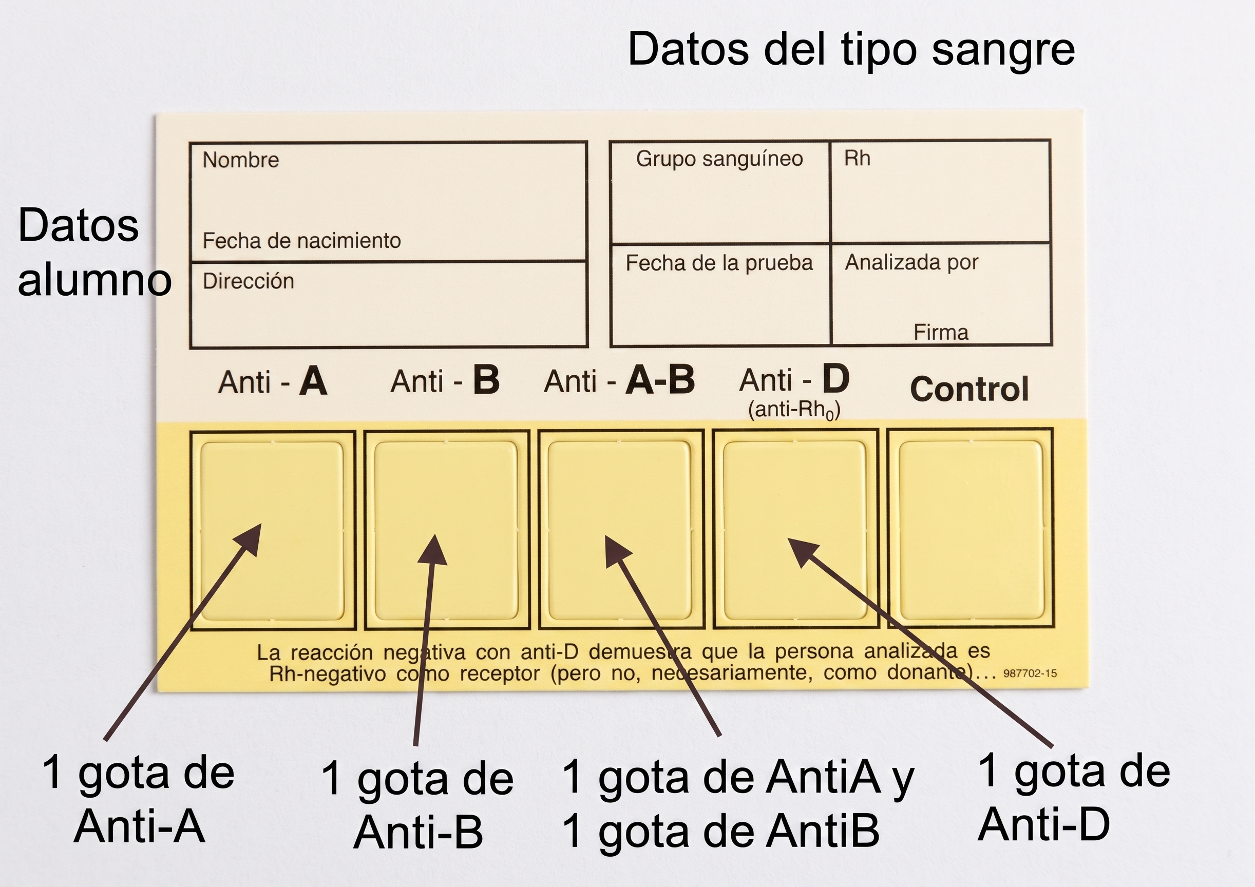 Tarjeta para determinar el grupo sanguíneo con reactivos Anti-A, Anti-B y Anti-D
